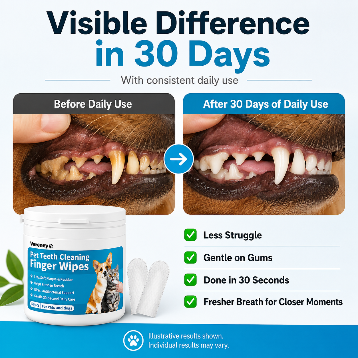 Vereney™ Plaque Control Wipes