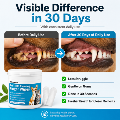 Vereney™ Plaque Control Wipes